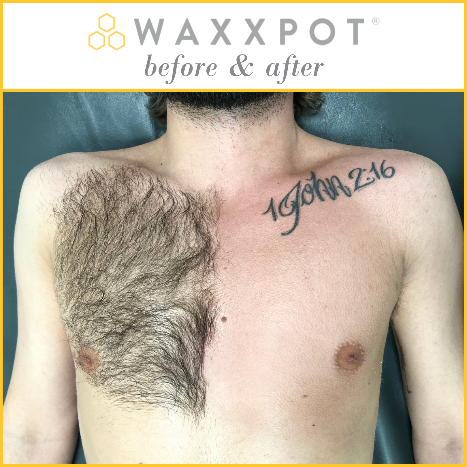 Chest Wax before & after
