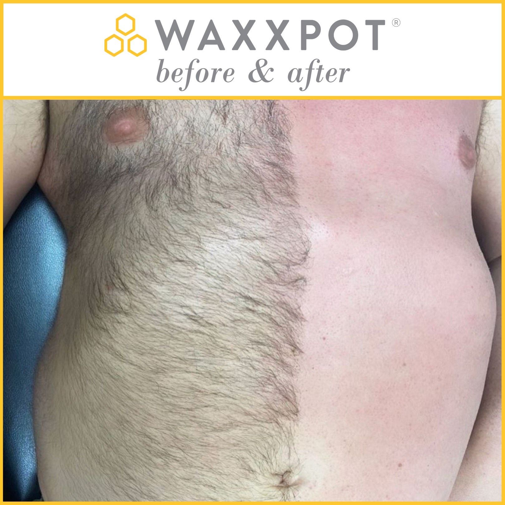 Waxxpot Before & After: Chest Wax