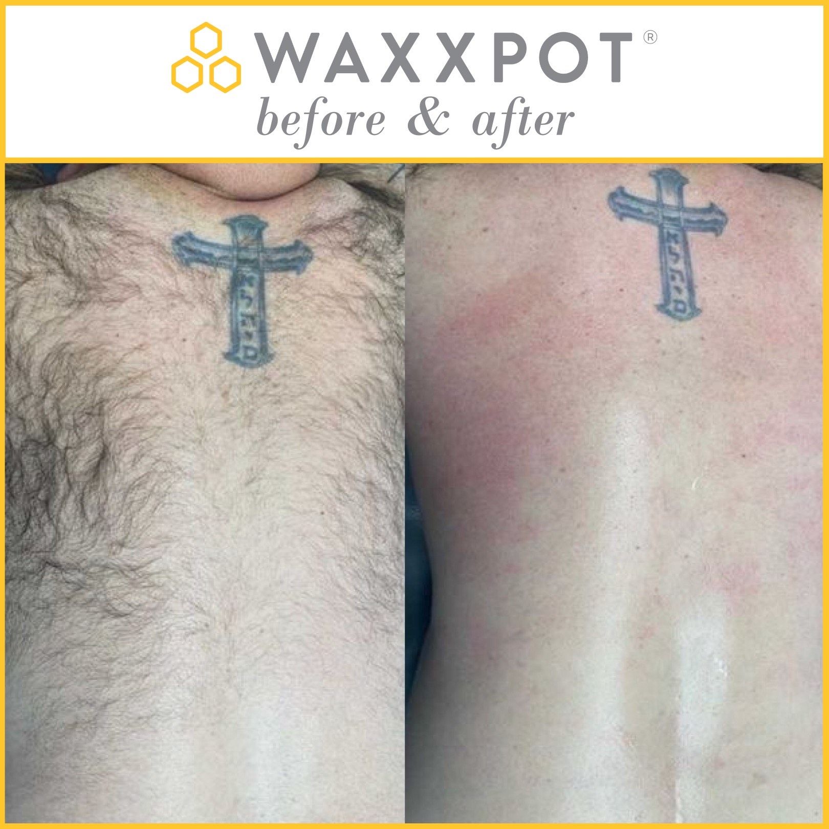 Waxxpot Before & After: Back Wax