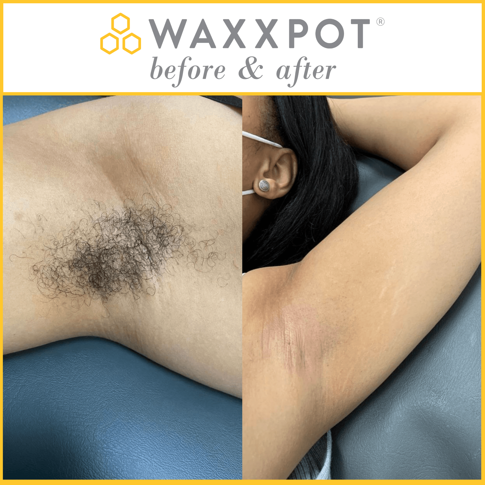 Waxxpot Underarm Wax before and after